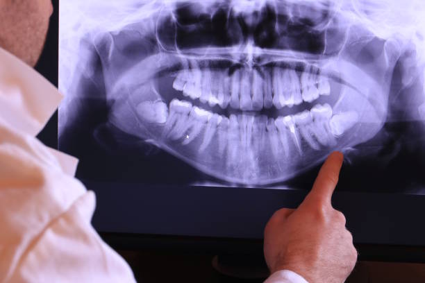 Best Emergency Treatment for Toothache in Salt Lake City, UT