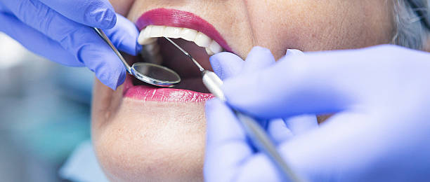 Best Emergency Tooth Extraction in Salt Lake City, UT